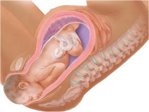 Quá trình dãn nở âm đạo để em bé đực ra ngoài